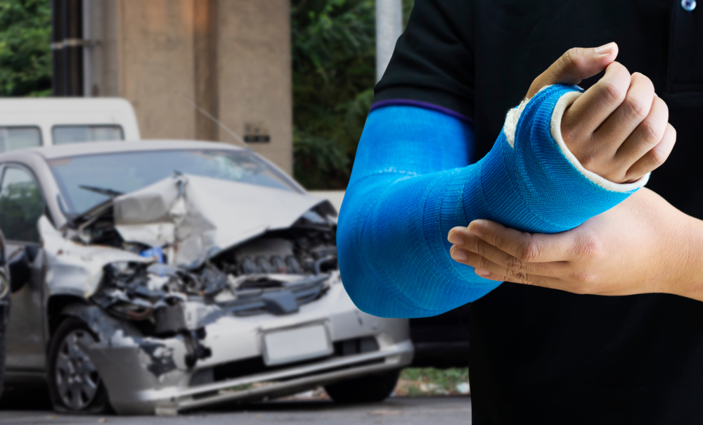 Fort Lauderdale Broken Bone Injury Attorney